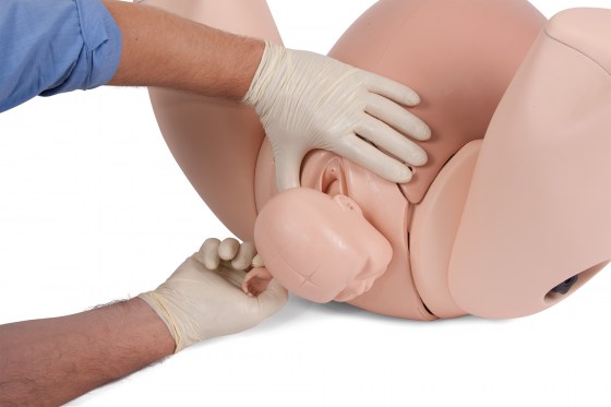 PROMPT Flex - posteriorní porod ruky